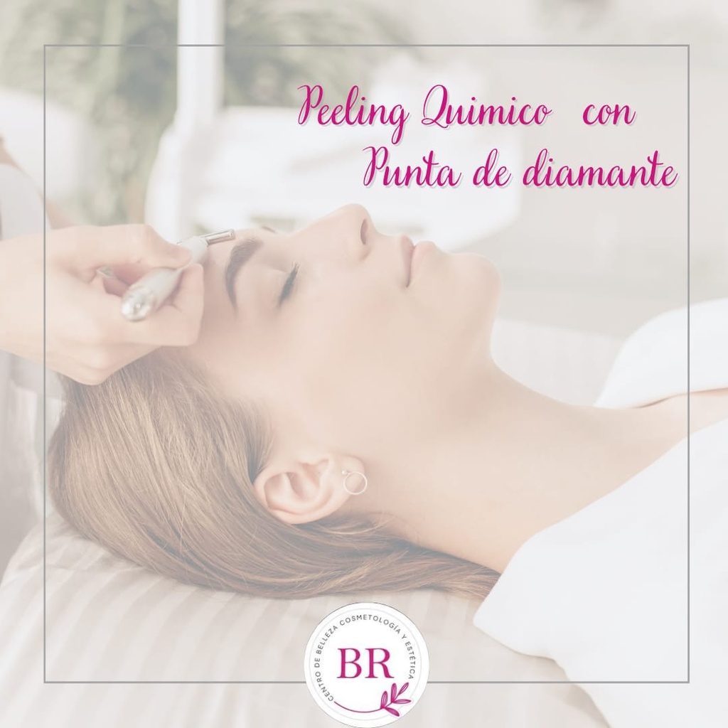 Peeling Quimico con Punta de Diamante