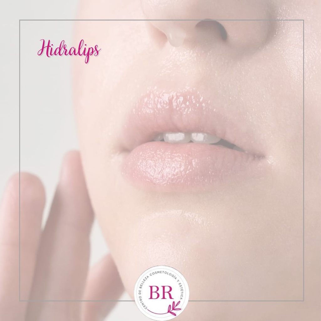 Hidralips